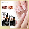 nail fungus treatment